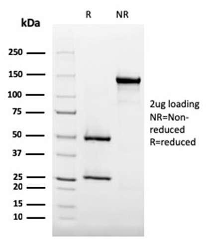 CD35/CR1 (Follicular Dendritic Cell Marker) Antibody in SDS-PAGE (SDS-PAGE)
