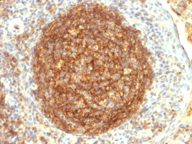 CD35/CR1 (Follicular Dendritic Cell Marker) Antibody in Immunohistochemistry (Paraffin) (IHC (P))