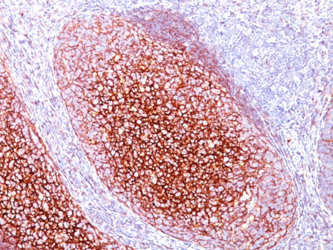 CD35/CR1 (Follicular Dendritic Cell Marker) Antibody in Immunohistochemistry (Paraffin) (IHC (P))