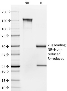 CD35/CR1 (Follicular Dendritic Cell Marker) Antibody in SDS-PAGE (SDS-PAGE)