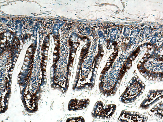 FABP6 Antibody in Immunohistochemistry (Paraffin) (IHC (P))