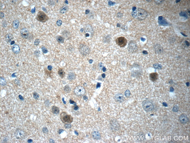 FGF12 Antibody in Immunohistochemistry (Paraffin) (IHC (P))