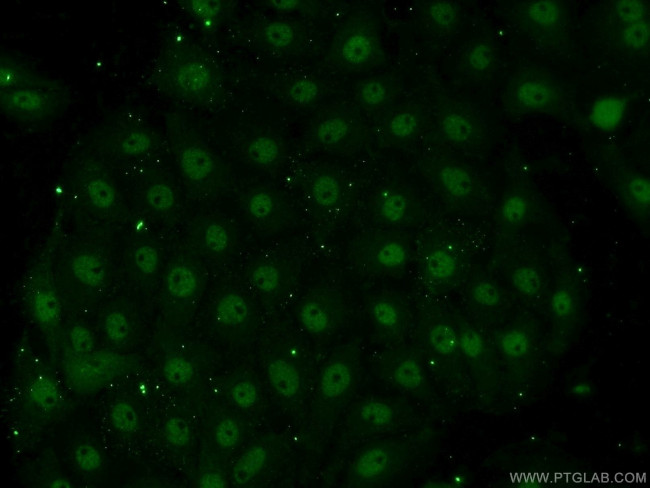 EAF1 Antibody in Immunocytochemistry (ICC/IF)