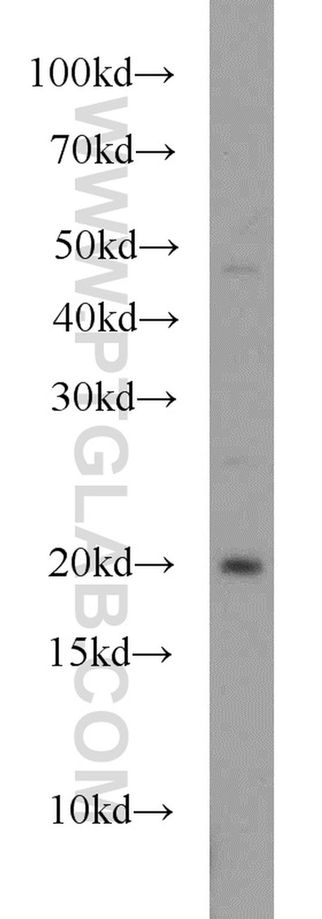 RAP2A Antibody in Western Blot (WB)