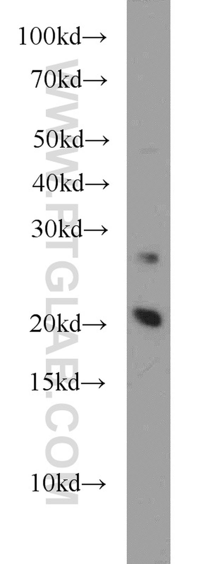 RAP2A Antibody in Western Blot (WB)