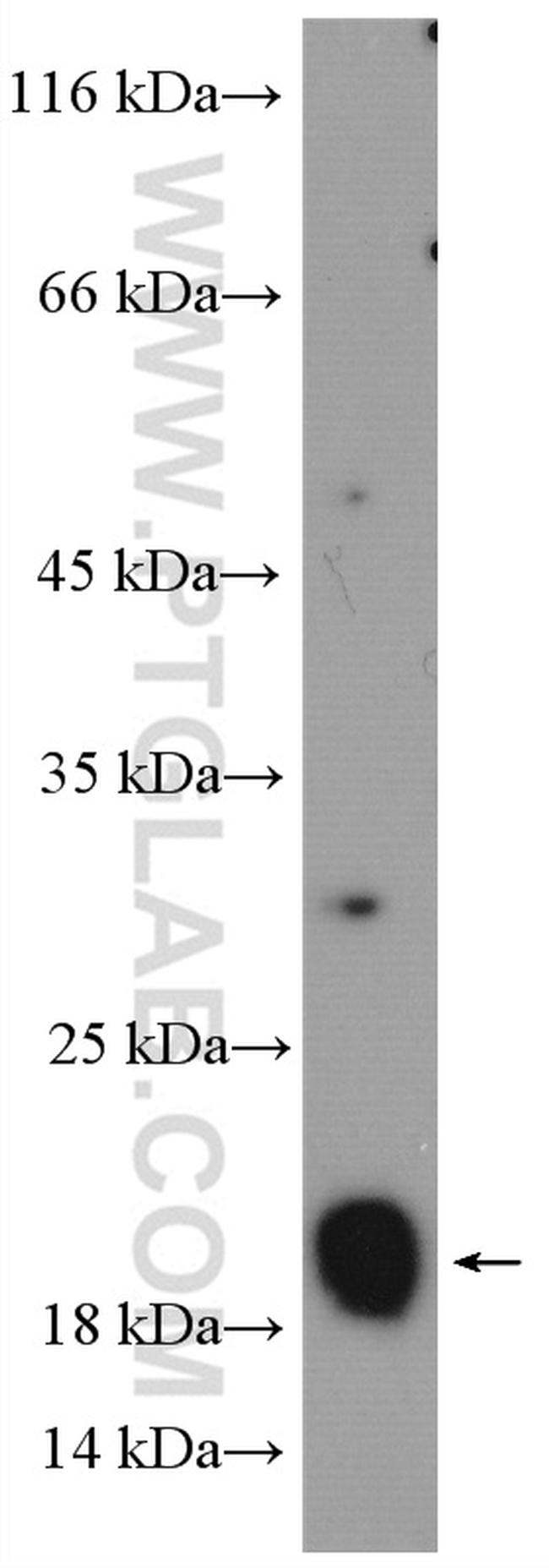 RAP2A Antibody in Western Blot (WB)