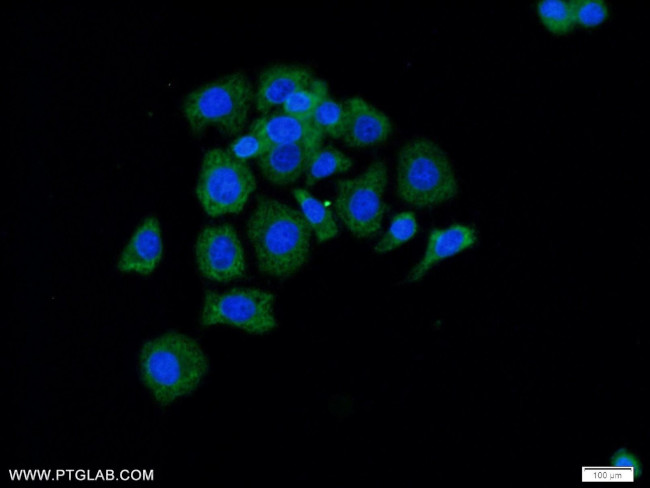 Radixin Antibody in Immunocytochemistry (ICC/IF)