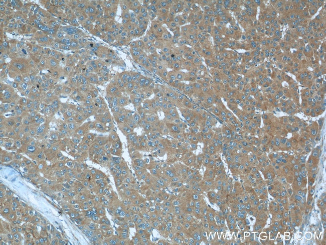 Radixin Antibody in Immunohistochemistry (Paraffin) (IHC (P))