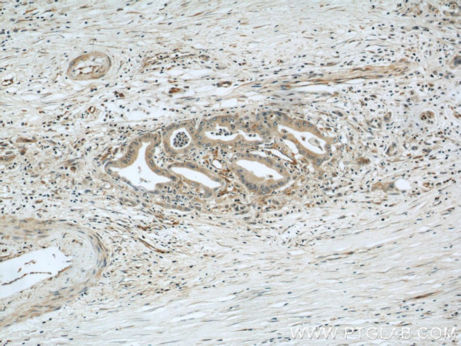 Radixin Antibody in Immunohistochemistry (Paraffin) (IHC (P))