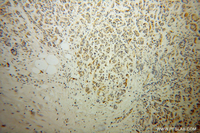 Radixin Antibody in Immunohistochemistry (Paraffin) (IHC (P))