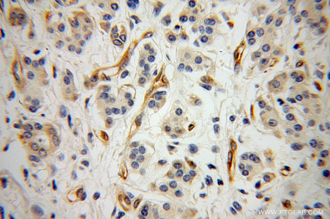 Radixin Antibody in Immunohistochemistry (Paraffin) (IHC (P))