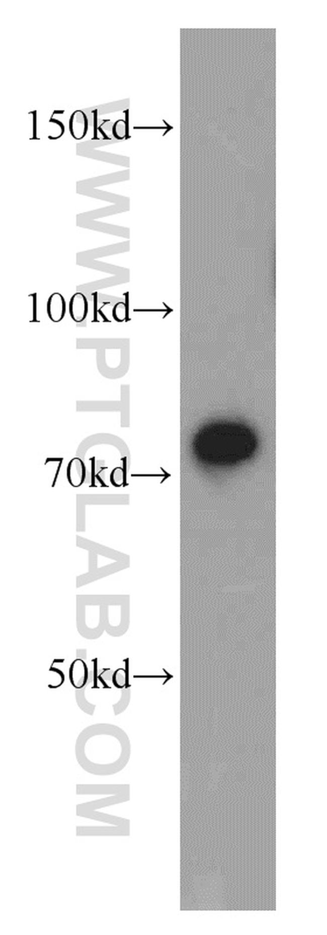 Radixin Antibody in Western Blot (WB)