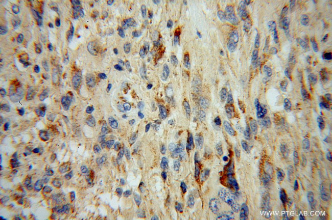 Spartin/SPG20 Antibody in Immunohistochemistry (Paraffin) (IHC (P))