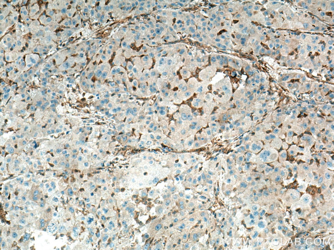 Spartin/SPG20 Antibody in Immunohistochemistry (Paraffin) (IHC (P))