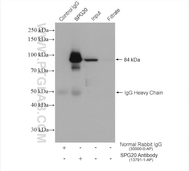 Spartin/SPG20 Antibody in Immunoprecipitation (IP)