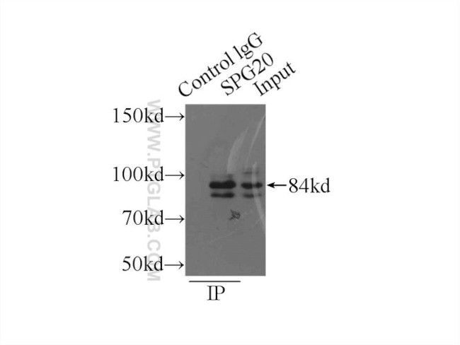 Spartin/SPG20 Antibody in Immunoprecipitation (IP)