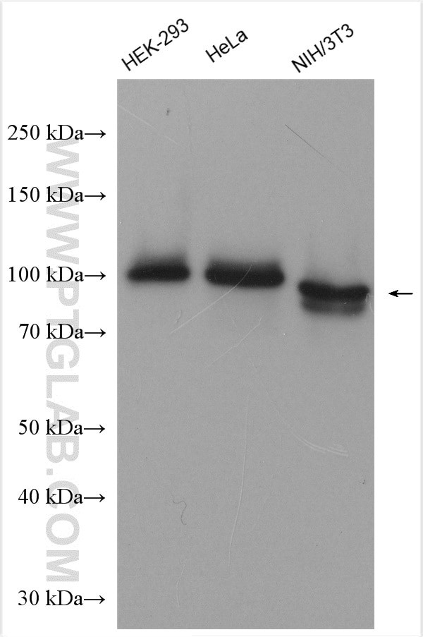 Spartin/SPG20 Antibody in Western Blot (WB)