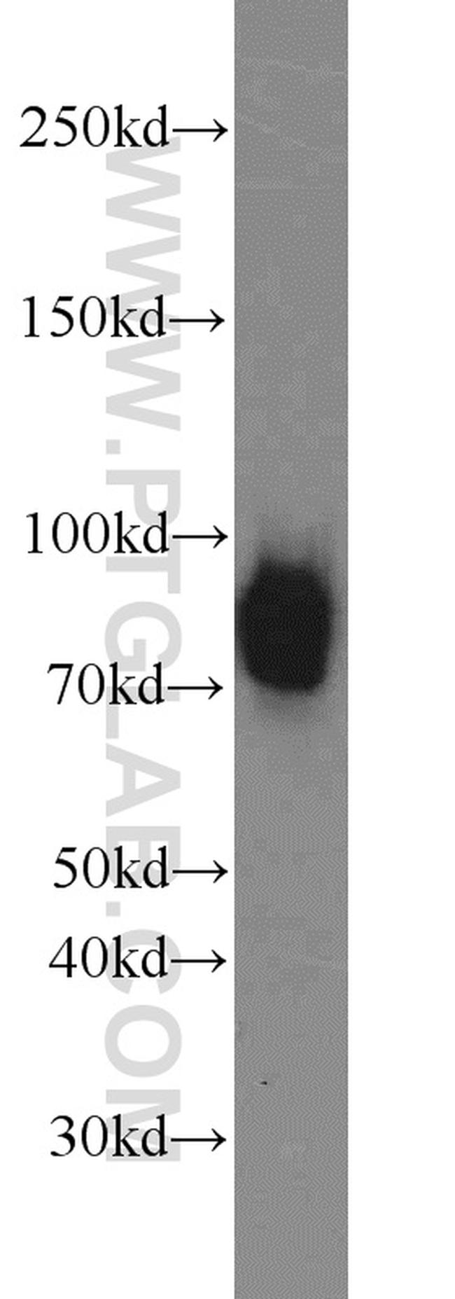 Spartin/SPG20 Antibody in Western Blot (WB)