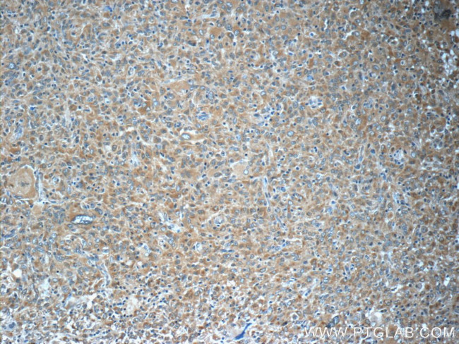 Spartin/SPG20 Antibody in Immunohistochemistry (Paraffin) (IHC (P))