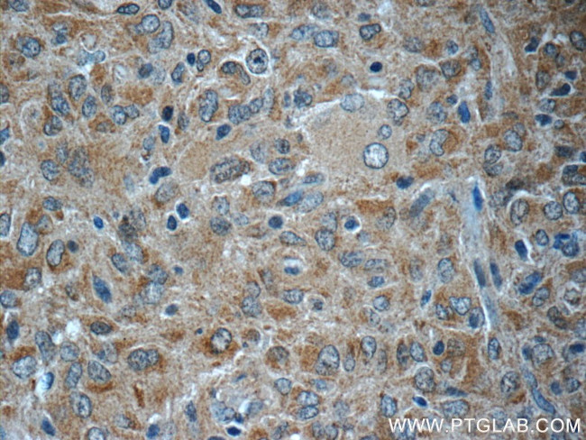 Spartin/SPG20 Antibody in Immunohistochemistry (Paraffin) (IHC (P))