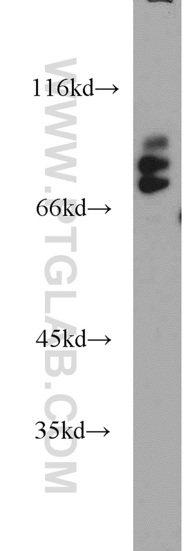 Spartin/SPG20 Antibody in Western Blot (WB)