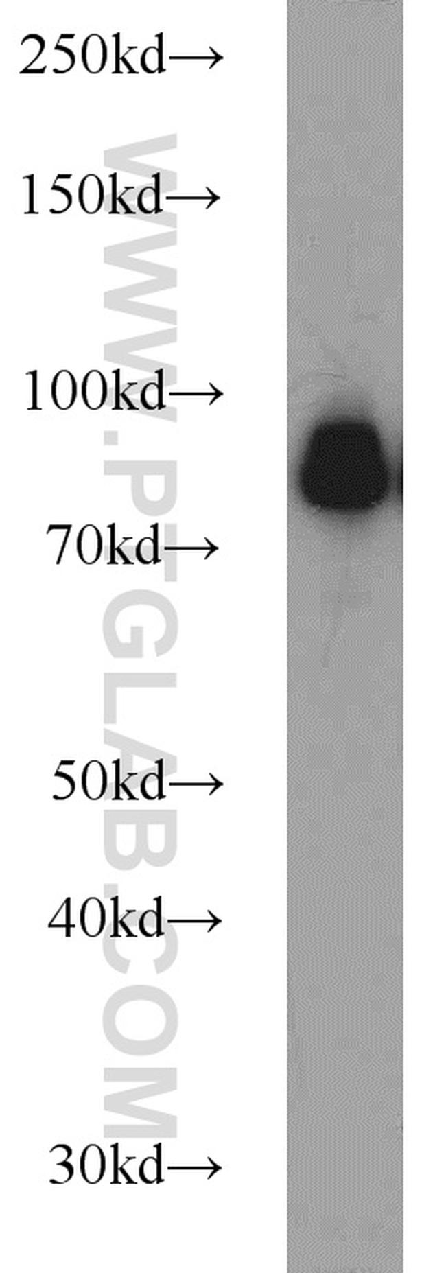 Spartin/SPG20 Antibody in Western Blot (WB)