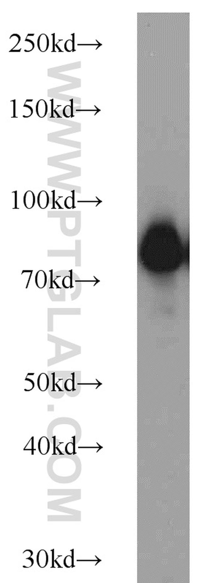 Spartin/SPG20 Antibody in Western Blot (WB)