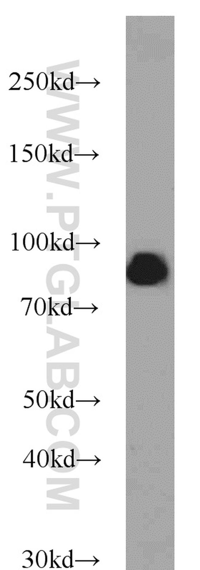 Spartin/SPG20 Antibody in Western Blot (WB)