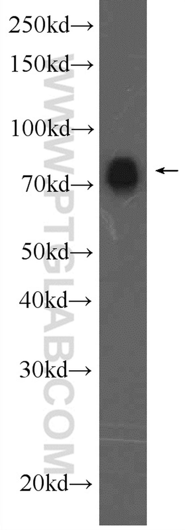 Spartin/SPG20 Antibody in Western Blot (WB)