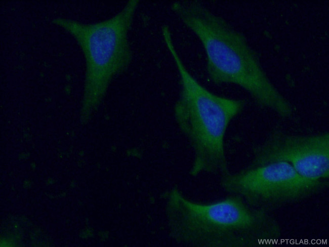 GAS6 Antibody in Immunocytochemistry (ICC/IF)