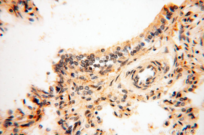 GAS6 Antibody in Immunohistochemistry (Paraffin) (IHC (P))