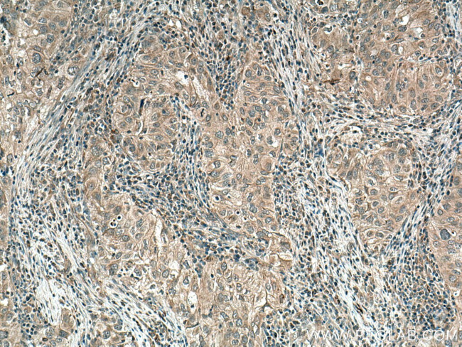 GAS6 Antibody in Immunohistochemistry (Paraffin) (IHC (P))