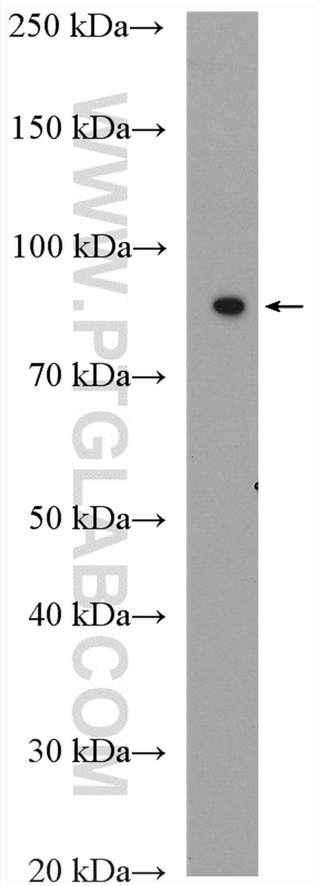 GAS6 Antibody in Western Blot (WB)