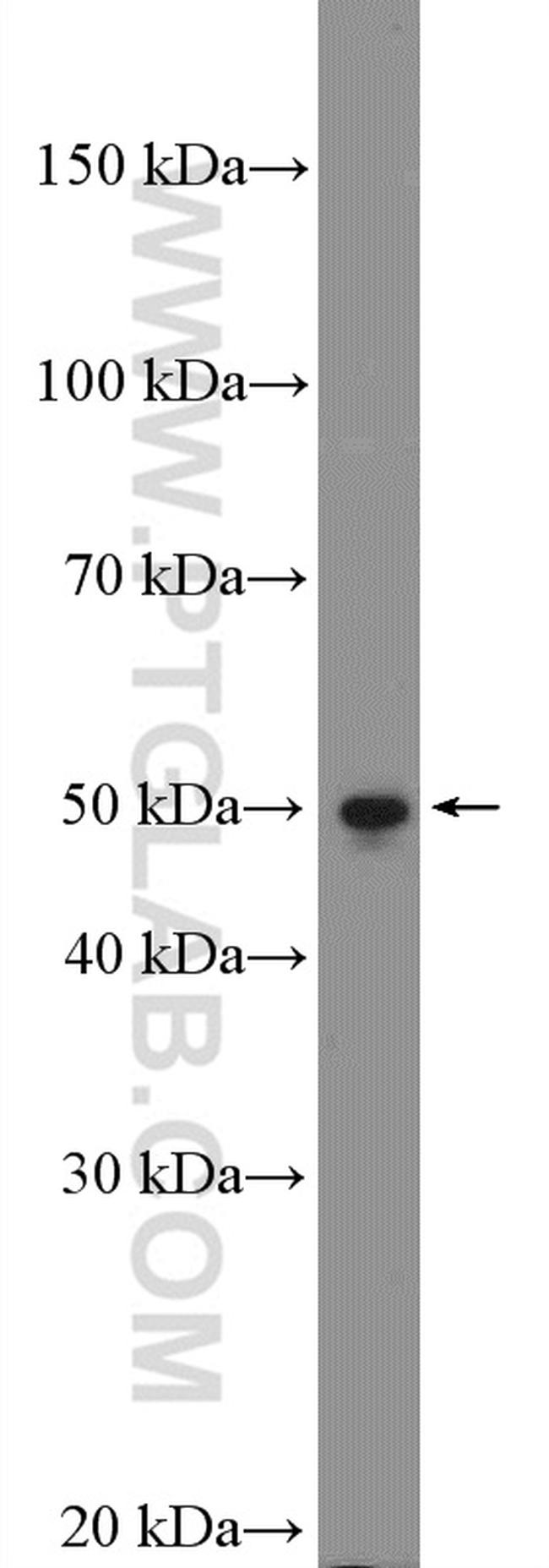 WBSCR16 Antibody in Western Blot (WB)