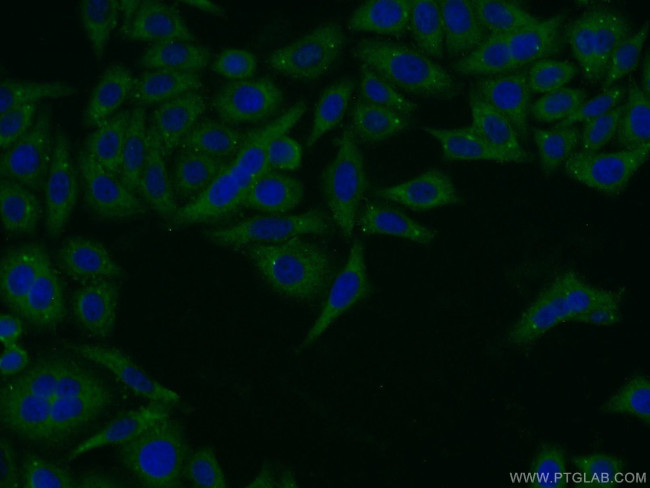 Pentraxin 3 Antibody in Immunocytochemistry (ICC/IF)