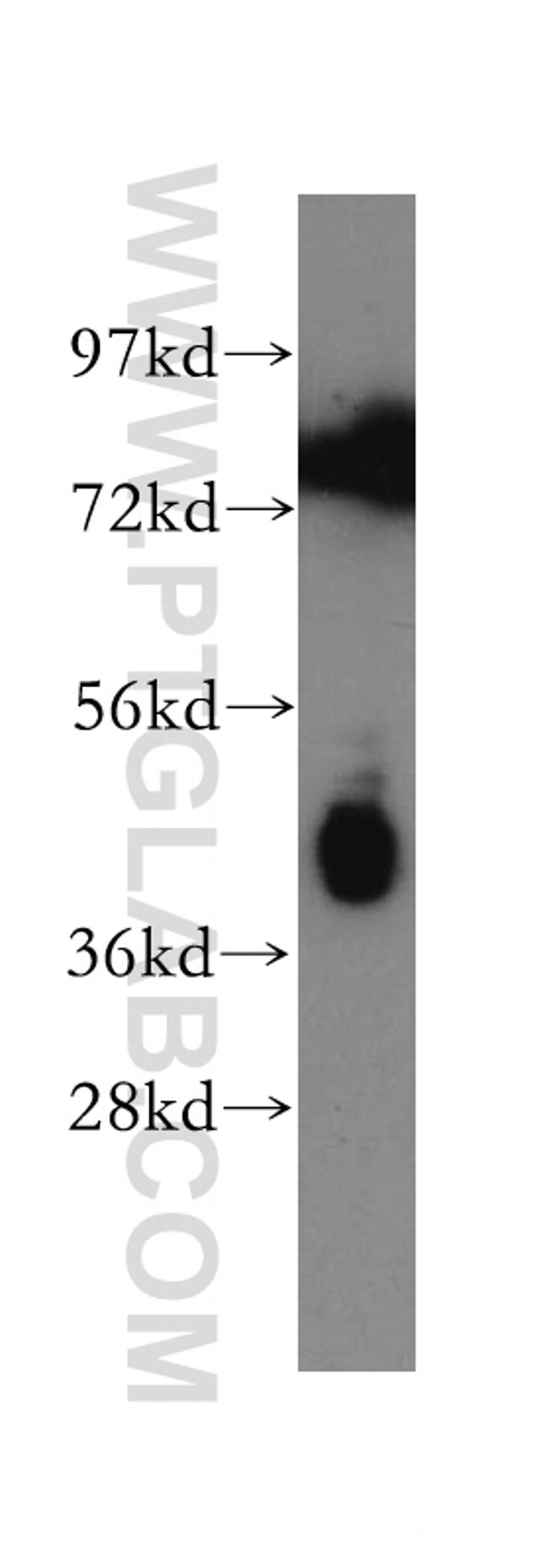 Pentraxin 3 Antibody in Western Blot (WB)