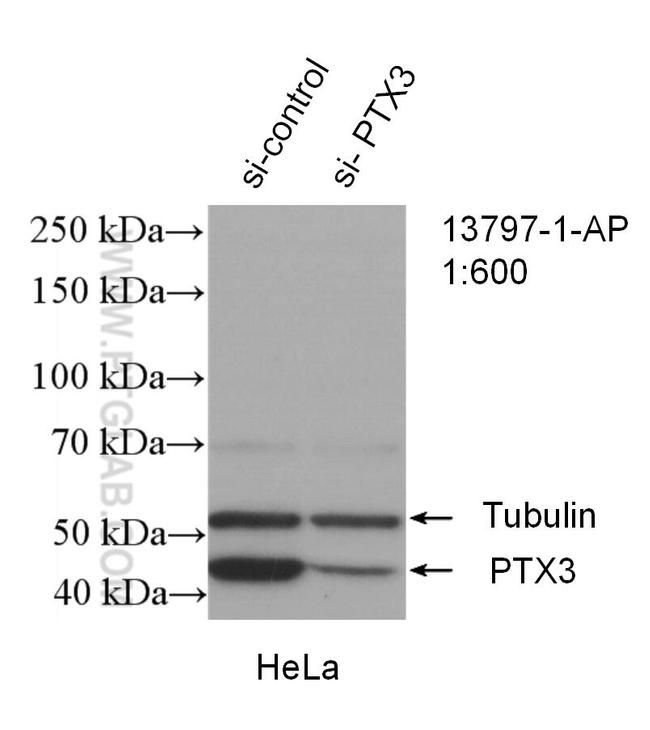 Pentraxin 3 Antibody in Western Blot (WB)