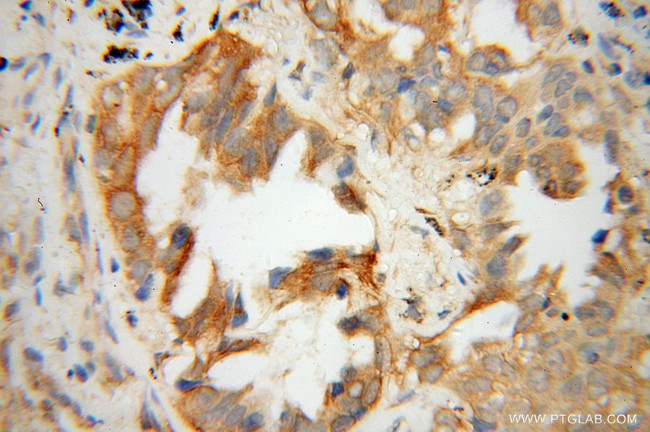 MFN1 Antibody in Immunohistochemistry (Paraffin) (IHC (P))