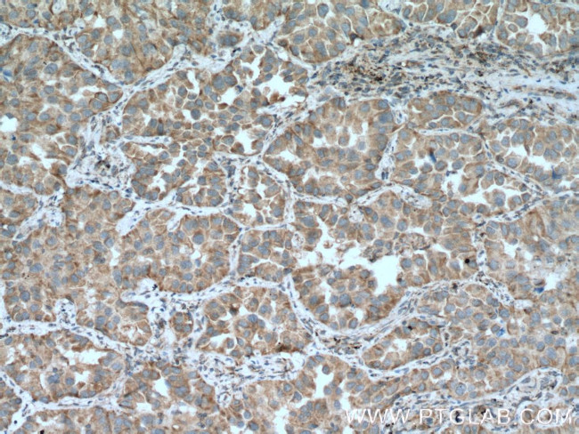 MFN1 Antibody in Immunohistochemistry (Paraffin) (IHC (P))