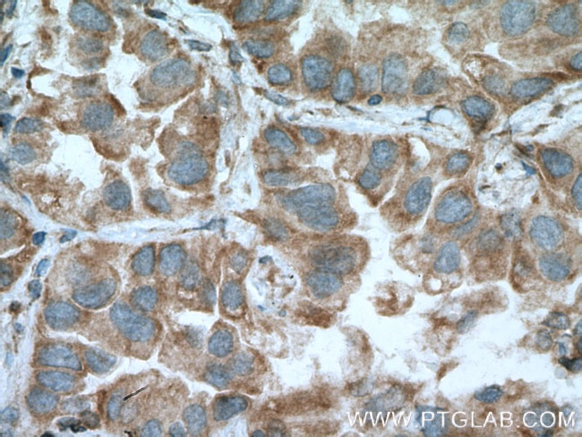 MFN1 Antibody in Immunohistochemistry (Paraffin) (IHC (P))