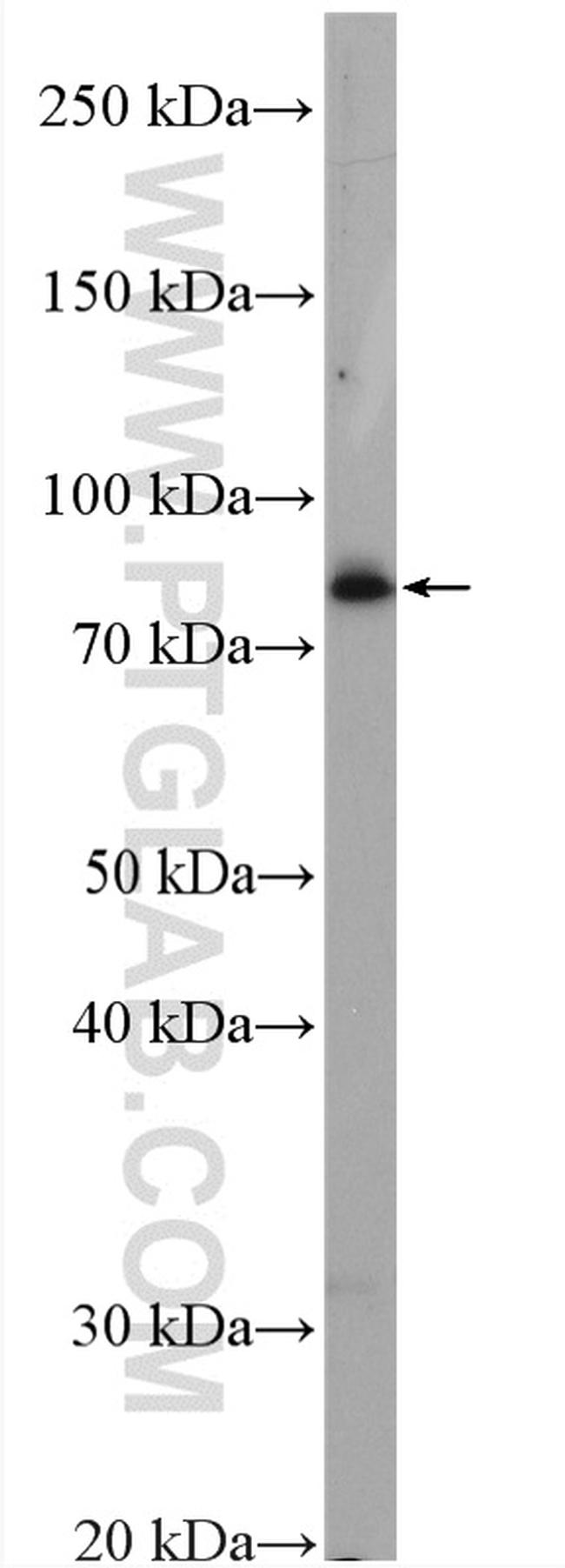 MFN1 Antibody in Western Blot (WB)