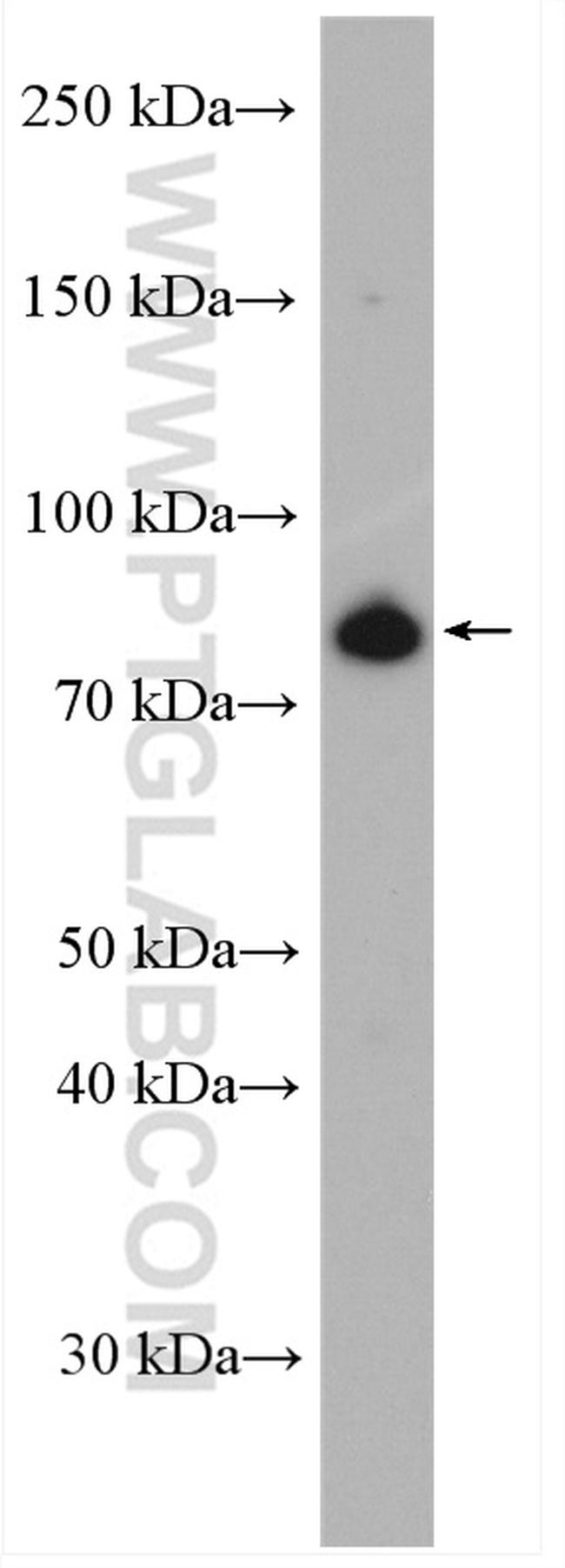 MFN1 Antibody in Western Blot (WB)