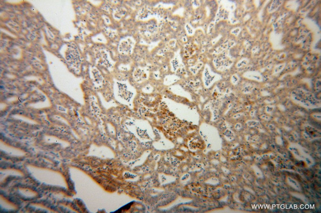 PARN Antibody in Immunohistochemistry (Paraffin) (IHC (P))