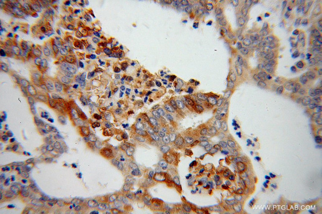 PARN Antibody in Immunohistochemistry (Paraffin) (IHC (P))