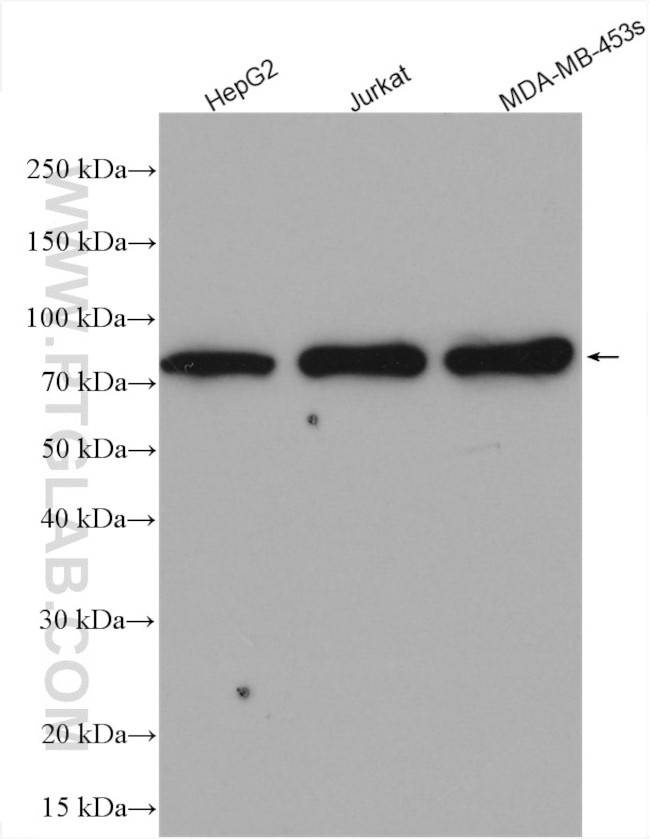 PARN Antibody in Western Blot (WB)