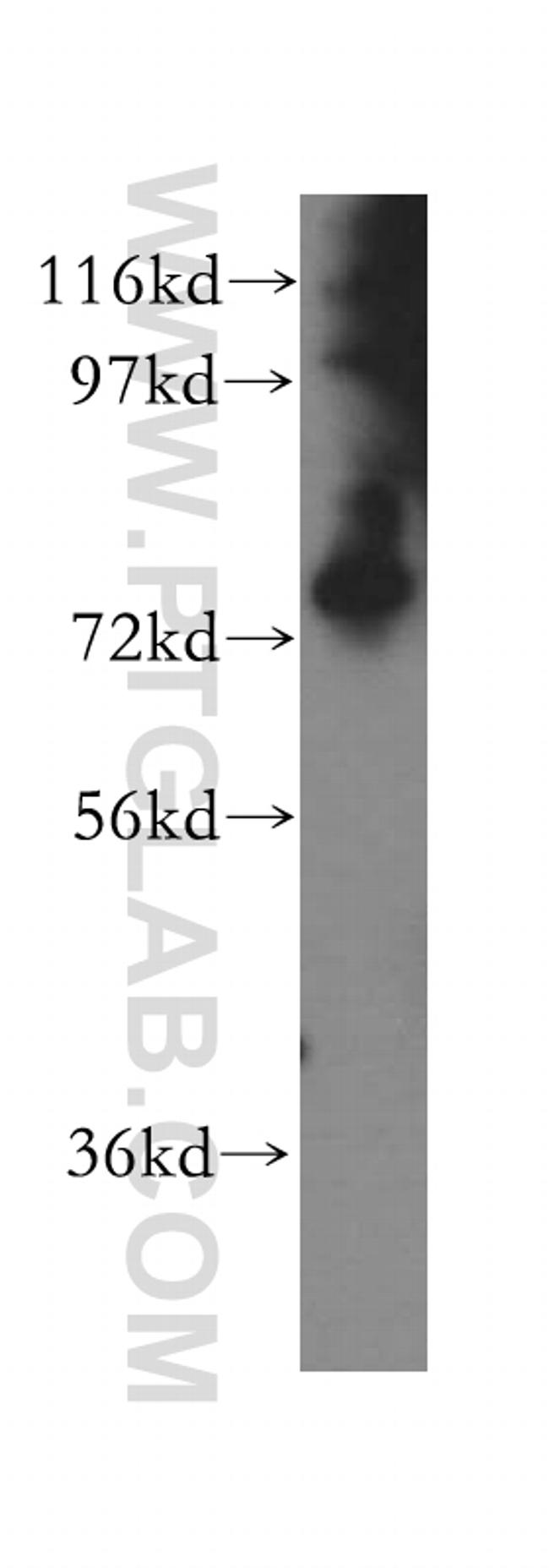 PARN Antibody in Western Blot (WB)