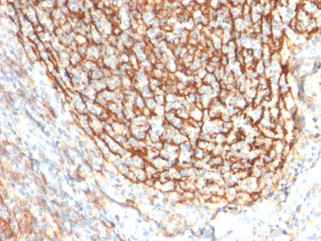 CD21 Antibody in Immunohistochemistry (Paraffin) (IHC (P))