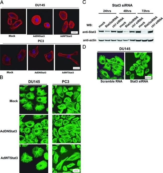 alpha Tubulin Antibody in Immunocytochemistry (ICC/IF)