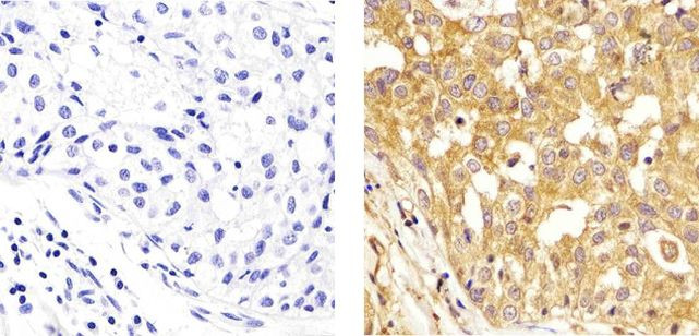 alpha Tubulin Antibody in Immunohistochemistry (Paraffin) (IHC (P))