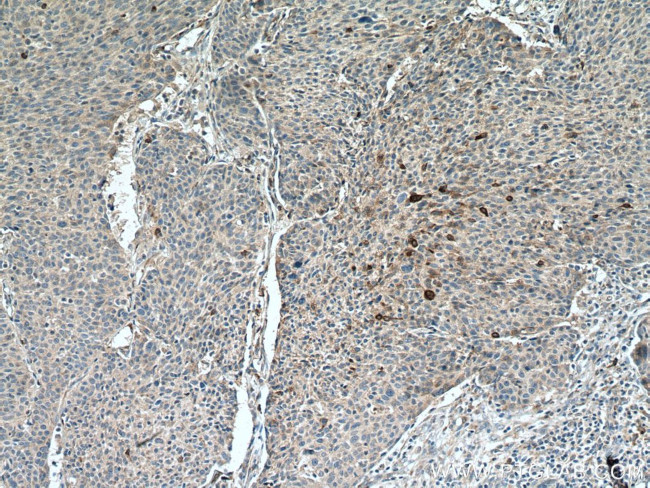 PAI-1 Antibody in Immunohistochemistry (Paraffin) (IHC (P))